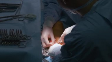 Profesyonel doktorlardan oluşan bir ekip cerrahi odasında açık ameliyat yapan bir hastayı ameliyat ediyor. Sağlık ve tıbbi müdahale kavramı
