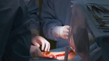 Profesyonel doktorlardan oluşan bir ekip cerrahi odasında açık ameliyat yapan bir hastayı ameliyat ediyor. Sağlık ve tıbbi müdahale kavramı