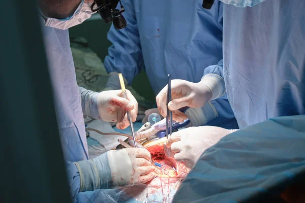 Closeup of professional doctor hands operating a patient during open heart surgery in surgical room. Healthcare and medical intervention concept — Stock Photo, Image