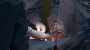 Profesyonel doktorlardan oluşan bir ekip cerrahi odasında açık ameliyat yapan bir hastayı ameliyat ediyor. Sağlık ve tıbbi müdahale kavramı.
