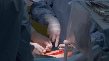 Cerrahi doktorlardan oluşan bir ekip bir hastayı ameliyat odasında ameliyat ediyor. Sağlık ve tıbbi yardım kavramı.