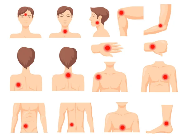 Concentración Del Dolor Partes Del Cuerpo Humano Con Manchas Rojas — Vector de stock