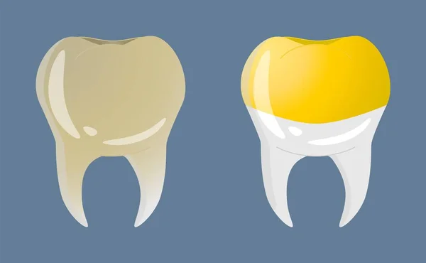 Δόντια Ρεαλιστικό Στυλ Κίτρινες Εικόνες Δοντιών Πολύχρωμη Διανυσματική Απεικόνιση Απομονωμένη — Διανυσματικό Αρχείο