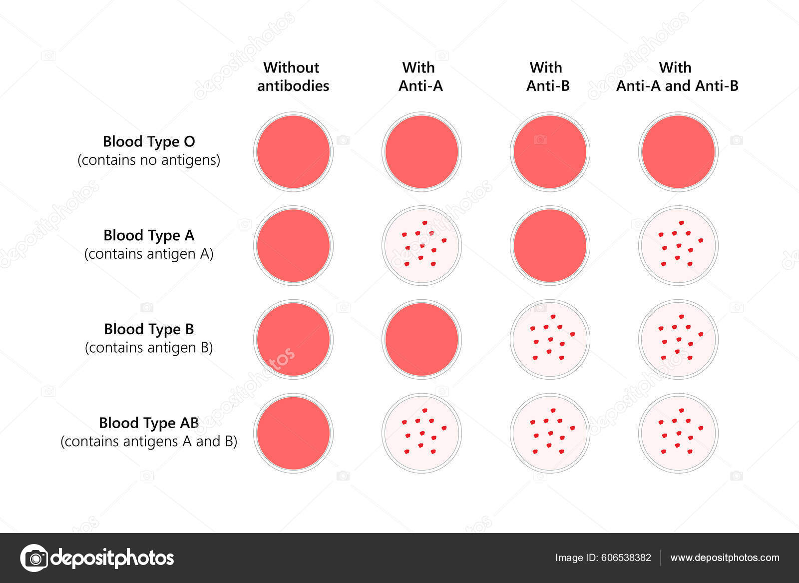 Blood Typing Abo Blood Types Stock Vector Image By AStepBioMed 606538382