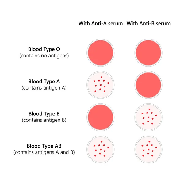 Blood Typing Abo Blood Types — Stock Vector