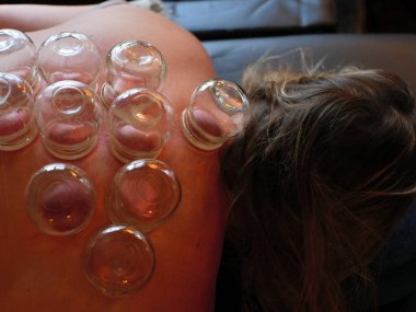 Sarışın, beyaz bir kadının sırtından terapi seansı.