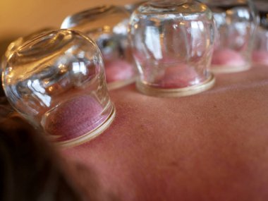 Sarışın, beyaz bir kadının sırtından terapi seansı.