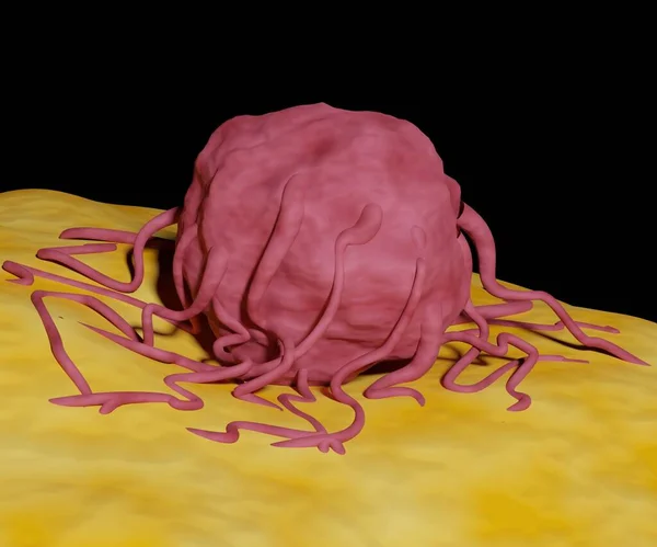 Tumore Crescita Incontrollata Verifica Nel Tessuto Solido Come Una Cellula — Foto Stock