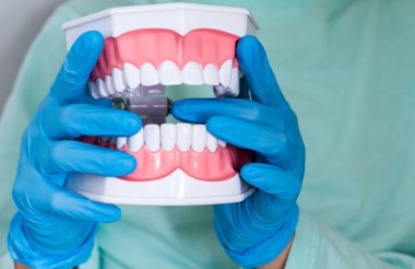 Tıp uzmanları için beyaz dişli üst ve alt çene modeli ve öğrencilerin tedavi, protez ve ortodonti hakkında öğrencilere öğretmek için.