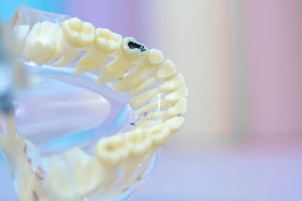 Transparent Silicone Model Upper Lower Jaw Medical Professionals Teaching Students — Stock Photo, Image