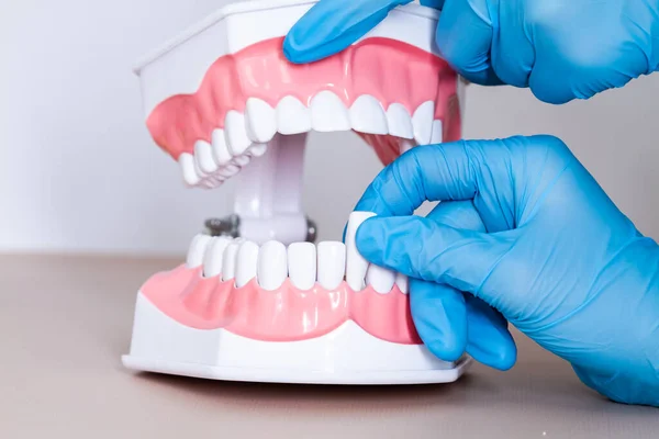 Model Szczęki Górnej Dolnej Białymi Zębami Dla Lekarzy Oraz Nauczania — Zdjęcie stockowe