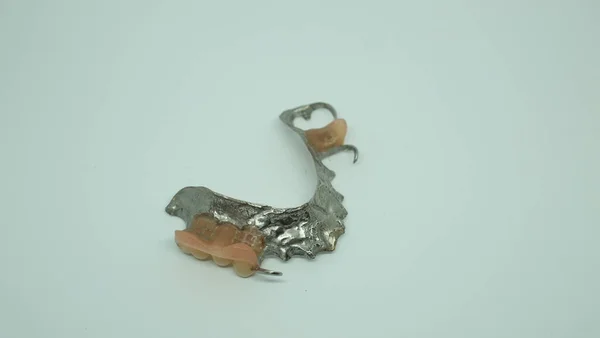 Fausses Dents Prothèse Amovible Isolées Sur Fond Blanc — Photo