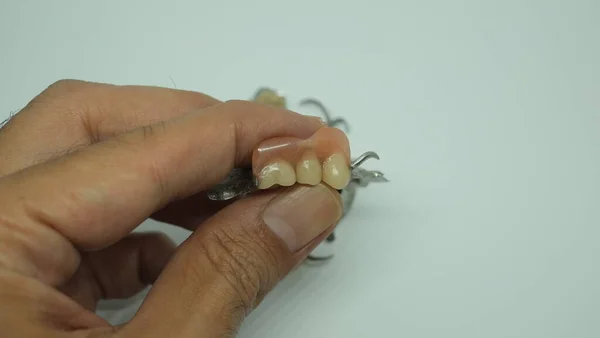 Hand holding false teeth or removable denture