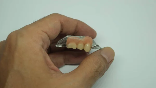 Mão Segurando Dentes Falsos Dentadura Removível — Fotografia de Stock