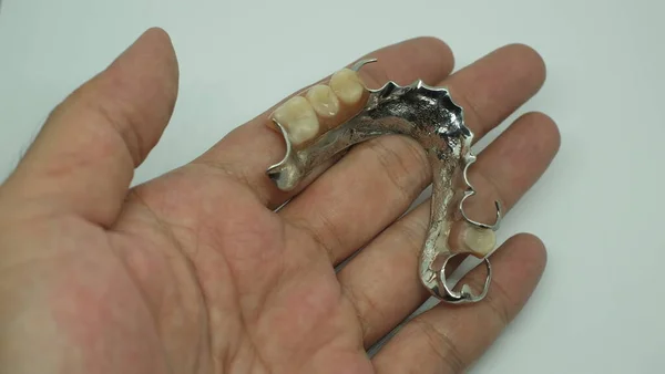 Mão Segurando Dentes Falsos Dentadura Removível — Fotografia de Stock