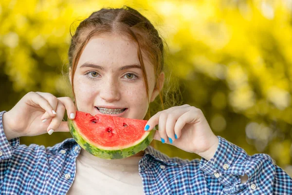 Bella Ragazza Adolescente Sorridente Con Anguria Cure Dentali Denti Trattamento — Foto Stock