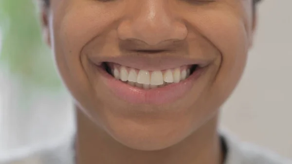 Fechar a boca sorridente da mulher africana — Fotografia de Stock