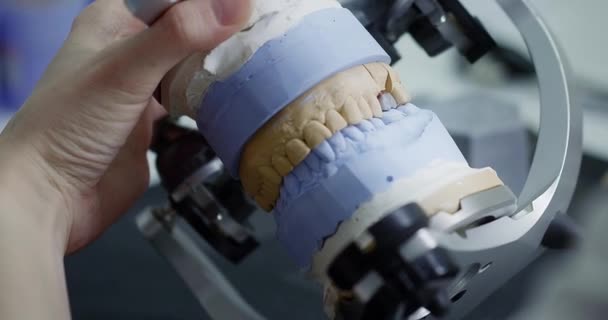 Стоматолог тримає в руках макет артикулятора щелепи . — стокове відео