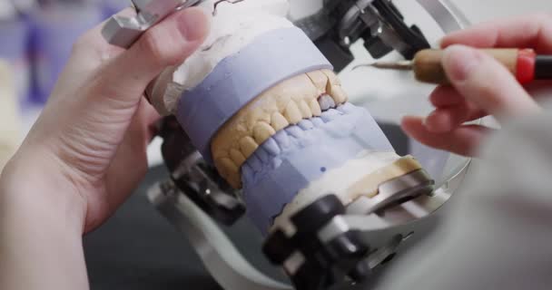 歯科技術者は顎関節のモックアップを手に持っています. — ストック動画