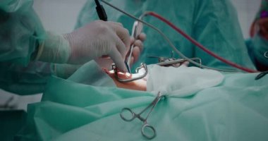 Doktor bademcikleri almak için pediatrik cerrahi bir operasyon yapıyor. Bademcik ameliyatı..