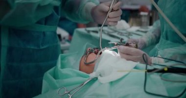 Doktor bademcikleri almak için pediatrik cerrahi bir operasyon yapıyor. Bademcik ameliyatı..