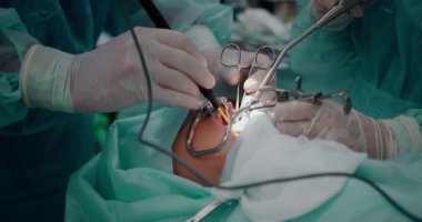 Doktor bademcikleri almak için pediatrik cerrahi bir operasyon yapıyor. Bademcik ameliyatı..