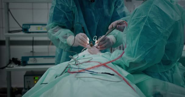 Врач проводит педиатрическую хирургическую операцию по удалению миндалин. Тонзиллэктомия. — стоковое видео