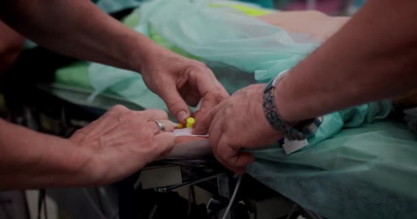 A enfermeira faz uma infusão intravenosa, preparando-se para a operação. Close-up de uma mão com um cateter. — Vídeo de Stock