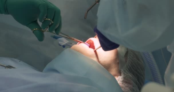 Le chirurgien applique une suture après avoir enlevé les dents de sagesse au patient — Video