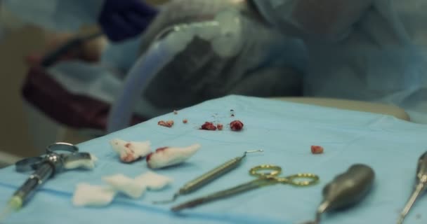 Instrumentos dentales quirúrgicos sobre la mesa durante la cirugía de extracción dental — Vídeos de Stock