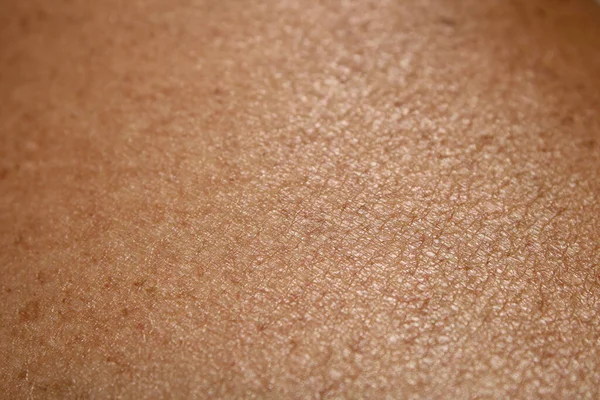 Close Aging Year Old Skin Color Texture — Stock Photo, Image