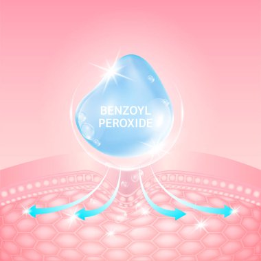 Serum Benzoyl Peroxide blue. Collagen Hyaluronic acid. Vitamin solution complex. Helps dissolve clogged acne reduce inflammation of acne. Beauty treatment nutrition skin care design. 3D Vector EPS10. clipart