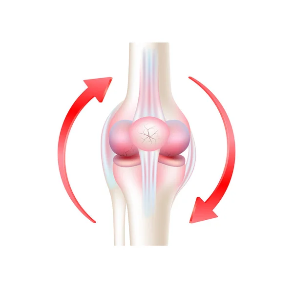 Beyaz arka planda izole edilmiş eklem iltihabı ve dairesel kırmızı ok. Ürün şablon tasarımı. Tıbbi kavramlar. 3D Gerçekçi Vektör EPS10.