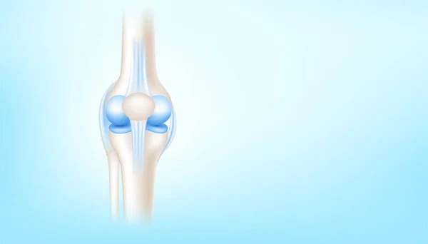 Articulación Rodilla Con Frente Cartílago Saludable Sobre Fondo Azul Con — Vector de stock