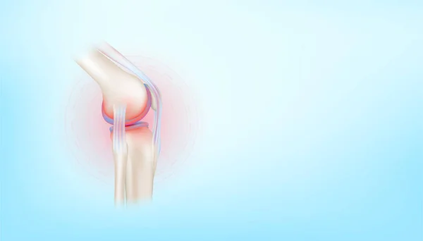 Artrit diz eklemi ve kıkırdak osteoartrit tarafında mavi arka planda metin için fotokopi alanı var. Vücut iskeletinin kemik insan iskeleti. Tıbbi sağlık bilimi konsepti. Gerçekçi 3B Vektör.