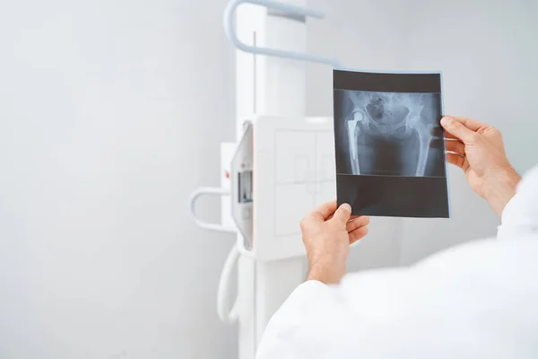 Lékař drží rukou skenování po ultrazvukové diagnostice. — Stock fotografie