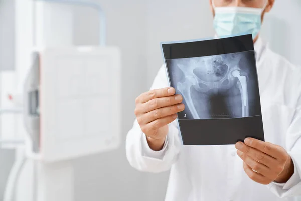 Сканування з зображенням кульшової кістки в руках лікарів . — стокове фото