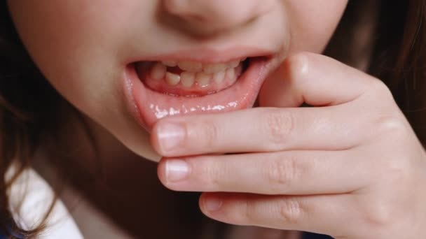 小孩掉了乳牙.7-9岁的可爱小女孩正在失去乳牙。将乳牙改为原生牙。孩子的牙医。牙膏。儿童牙科诊所 — 图库视频影像