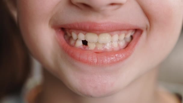 Close-up mouth child has lost one milk teeth. Replacement of permanent changing teeth, toothless smile and hole in the gum. Children is dentistry concept — Stock Video