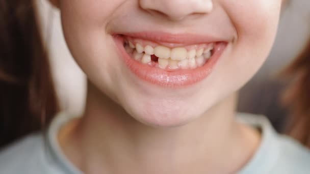 Liten flicka med tand första mjölk tillfällig tand. Tandmedicin eller tillfälliga tänder vård koncept. Autentisk bild av söt liten flicka ler i kameran med förfallna tänder inne i hennes hus — Stockvideo