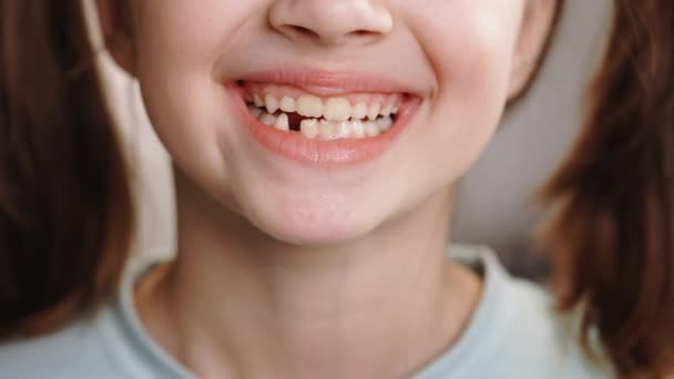 Retrato de cerca de la joven niña caucásica sonriendo con una sonrisa sin dientes. Pérdida de dientes de leche, reemplazo de dientes permanentes. Niños es odontología. No muestres dientes. Retire el diente de leche. — Vídeos de Stock