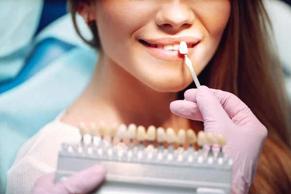 Mujer Joven Con Muestras Color Dientes Coincidencia Los Tonos Los — Foto de Stock