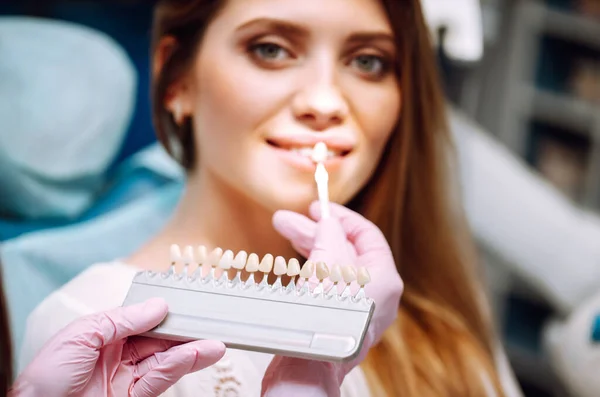 歯の色のサンプルを持つ若い女性 日陰ガイドを使用してインプラントの色合いを一致させます 歯科における歯のホワイトニングの準備 — ストック写真