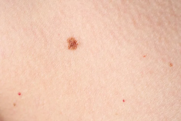 Hintergrund Einer Rosafarbenen Hautstruktur Gesunde Haut Makroaufnahme Von Hautzellen — Stockfoto