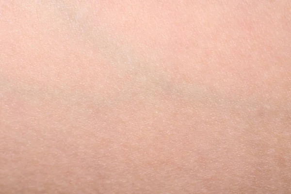 Background Pink Skin Texture Healthy Skin Macro Photo Skin Cells — Stock Photo, Image