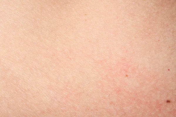 Background Pink Skin Texture Healthy Skin Macro Photo Skin Cells — Stock Photo, Image