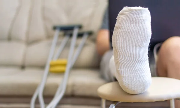 Kanepede Dizüstü Bilgisayarı Olan Bir Adam Oturuyor Alçılı Bir Bacak — Stok fotoğraf