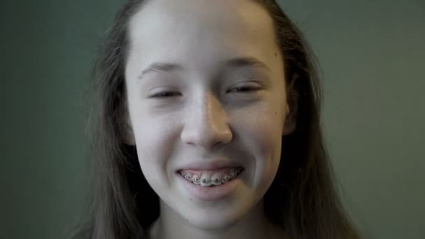Uma adolescente bonita e sorridente olha para a câmera e mostra aparelhos de metal em sua boca. Close-up de um rosto de crianças e boca com aparelho. 4K — Vídeo de Stock