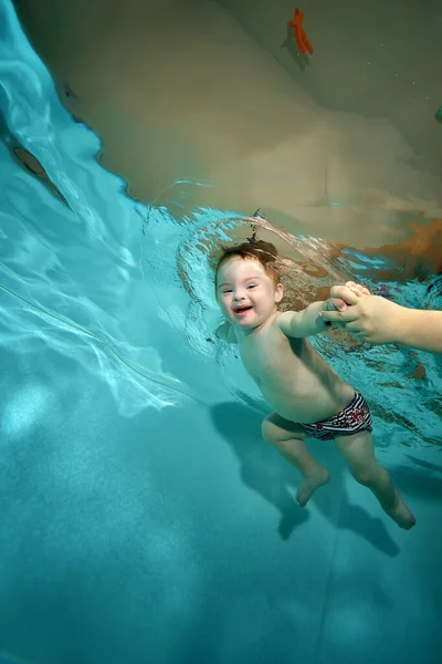 Un niño sonriente con síndrome de Down nada bajo el agua en una piscina infantil con agua azul, y su madre sostiene sus manos. Discapacidad infantil. Concepto. Retrato. Orientación vertical. — Foto de Stock