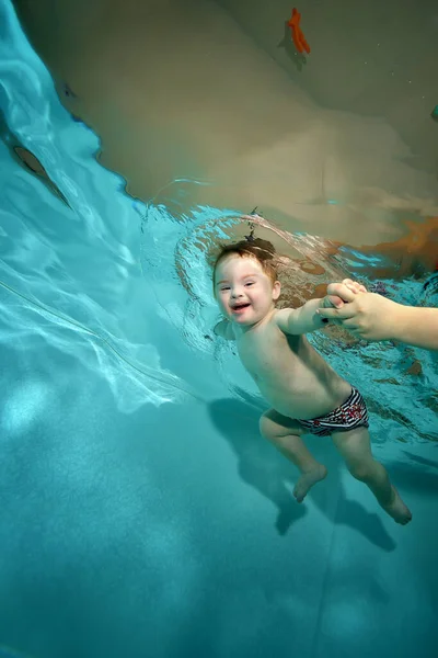 Усміхнений маленький хлопчик з синдромом Дауна плаває під водою в дитячому басейні з блакитною водою, а його мати тримає руки. Дитяча інвалідність. Поняття. Портрет. Вертикальна орієнтація . Стокове Фото